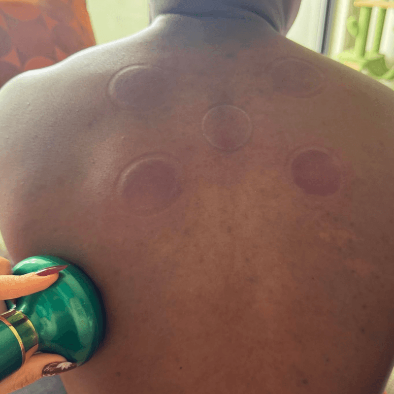 TensionFix™ 12-Level Electric Cupping Massager – Heated Vacuum Gua Sha Therapy for Cellulite & Muscle Relief
