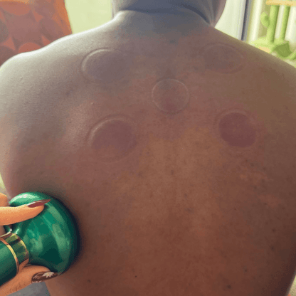 TensionFix™ 12-Level Electric Cupping Massager – Heated Vacuum Gua Sha Therapy for Cellulite & Muscle Relief