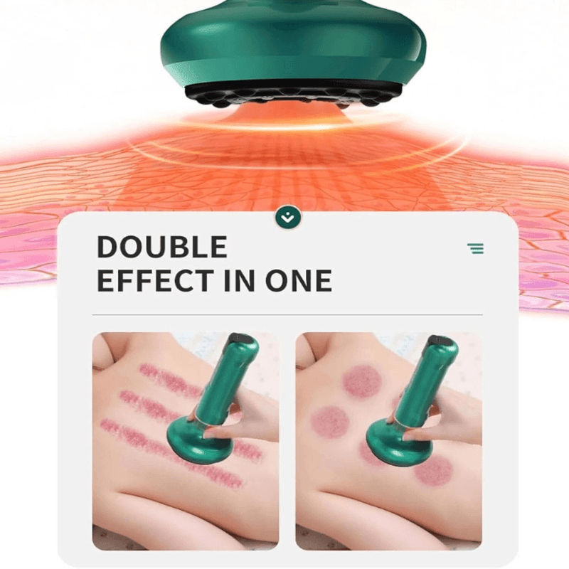 TensionFix™ 12-Level Electric Cupping Massager – Heated Vacuum Gua Sha Therapy for Cellulite & Muscle Relief