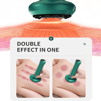 TensionFix™ 12-Level Electric Cupping Massager – Heated Vacuum Gua Sha Therapy for Cellulite & Muscle Relief