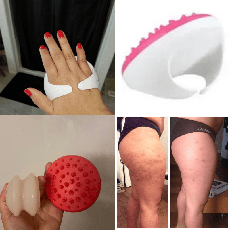 TensionFix™ 3-in-1 Anti-Cellulite Massager – Scrubber, Fat Roller & Exfoliator