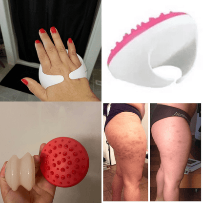 TensionFix™ 3-in-1 Anti-Cellulite Massager – Scrubber, Fat Roller & Exfoliator